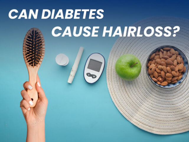 Blog cover of article "Can diabetes cause hair loss?"
