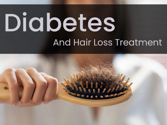 Comb with full of hair with text that says Diabetes and Hair Loss Treatment