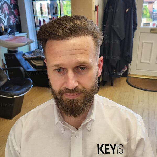Front view of a man with thick and dense hair strands, displaying high hair density.