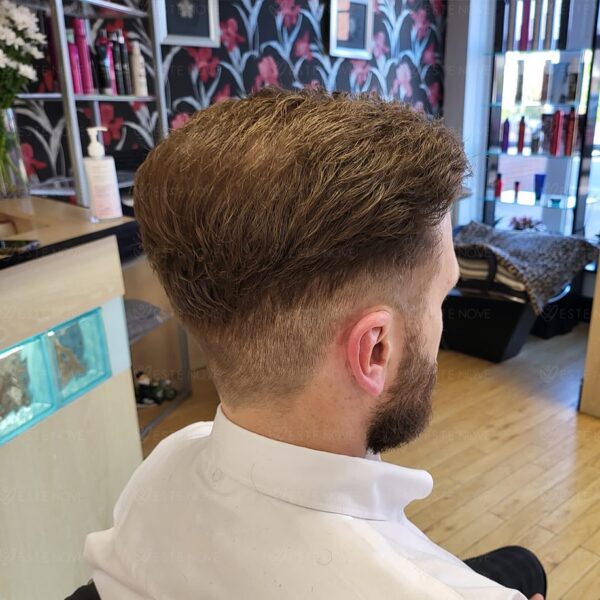 Back view showing full coverage and compact follicle distribution characteristic of high density.