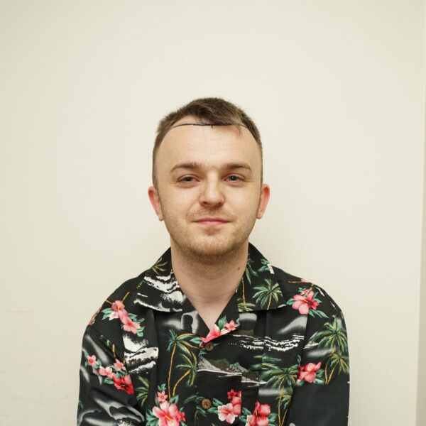 Frontal photo of an individual with balanced medium hair density and even coverage.