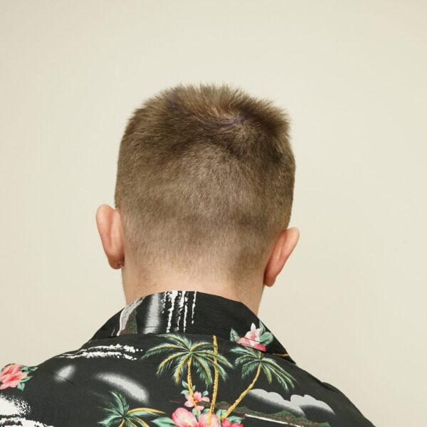 Back view highlighting typical coverage and natural volume of medium-density hair.