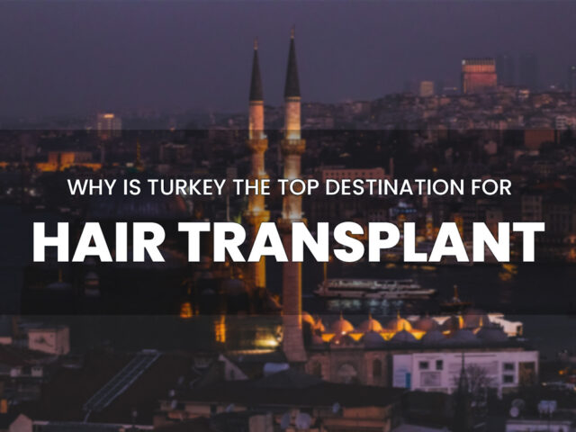 Text saying Why is Turkey the Top Destination for Hair Transplant with Istanbul in the background