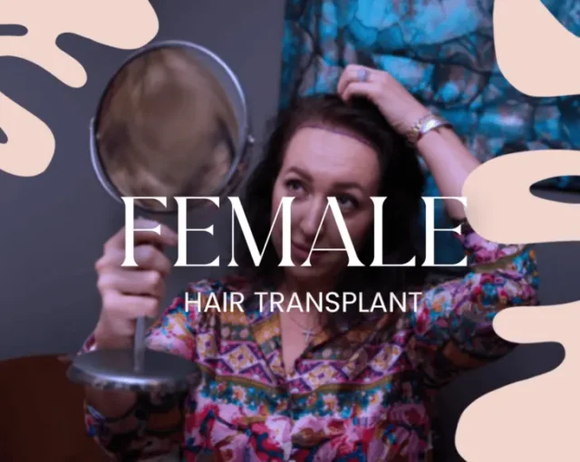 female hair transplant