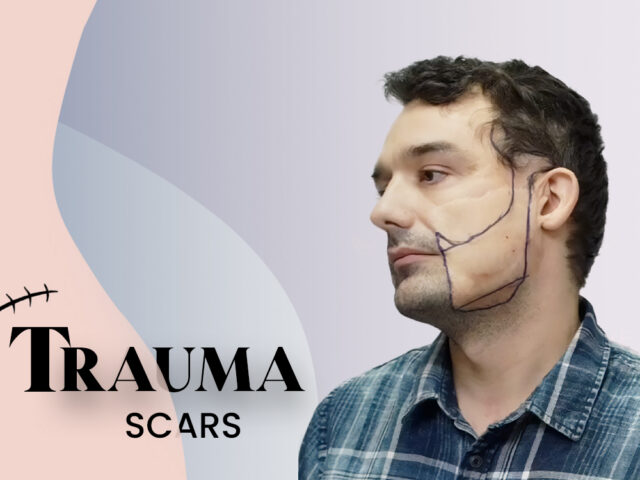men with trauma scar