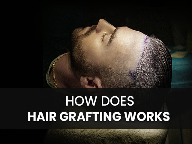 how does hair grafting works