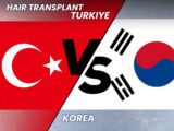 hair-transplanat-korea-vs-turkey