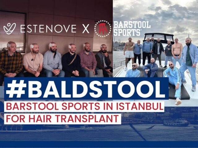 Barstool Hair Transplant Turkey