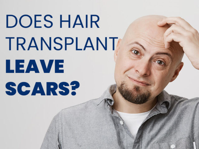 Does Hair Transplant Leave Scars