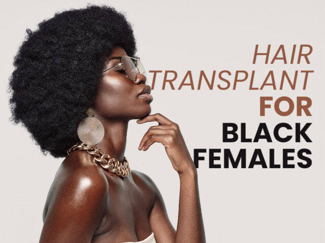 Hair Transplant for Black Females in Turkey
