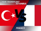 Hair Transplan in Turkey vs France