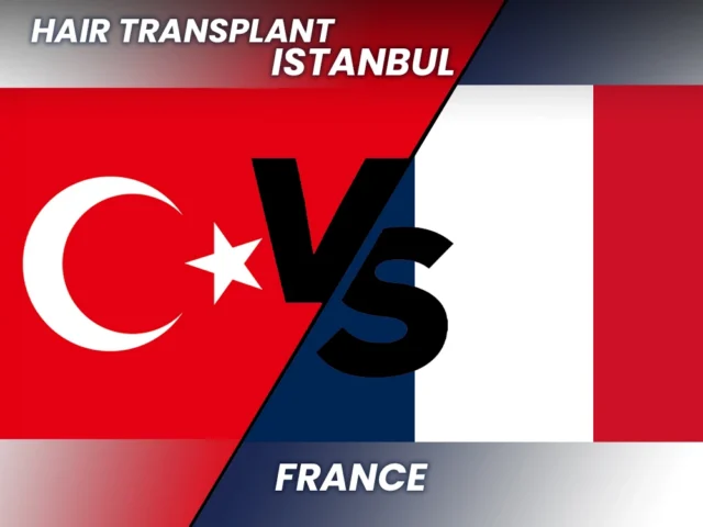 Hair Transplan in Turkey vs France