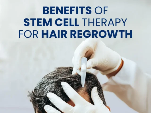 Gloved hands applying a treatment to a scalp with text "Benefits Of Stem Cell Therapy For Hair Regrowth"