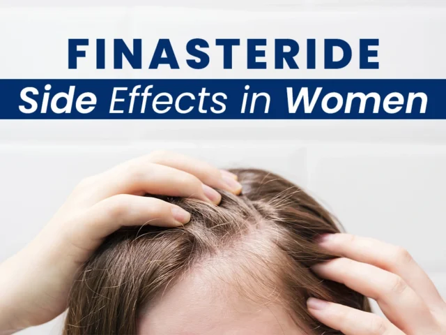 Finasteride-Side-Effects-in-Women