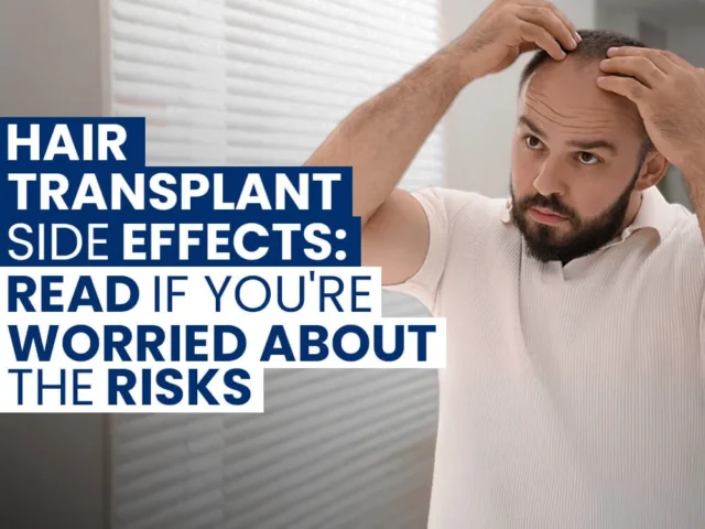 Man inspecting his receding hairline in a mirror with text about hair transplant side effects and risks.