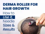 Person using a derma roller on their scalp with text about using a derma roller for hair growth, needle sizes, and results.
