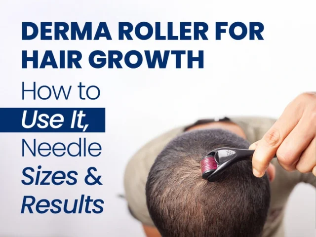 Person using a derma roller on their scalp with text about using a derma roller for hair growth, needle sizes, and results.
