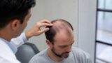 norwood type 5 hair transplant