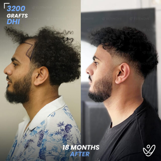 Hossam - 4