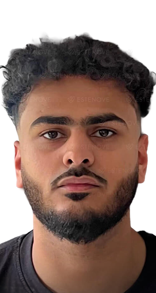 Hossam - after