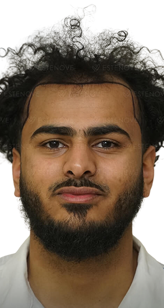Hossam - before